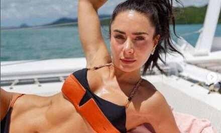 Johanna Fadul causó revuelo por mostrar el proceso de su cirugía estética